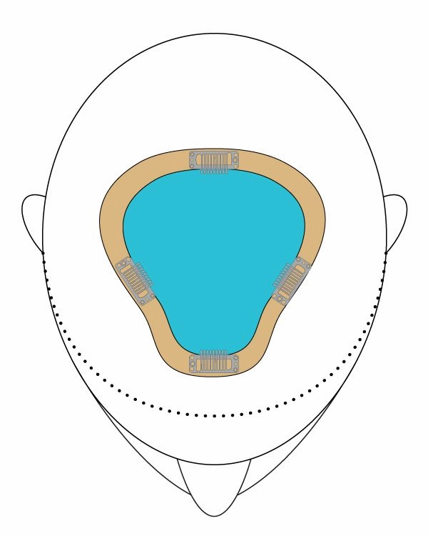 EASIPART HD XL 8"