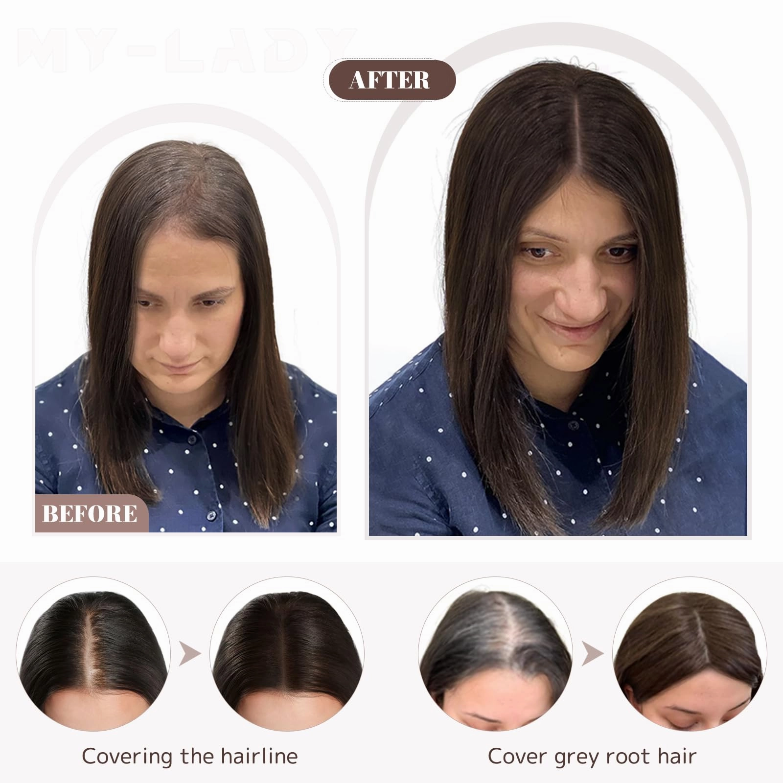 Human Hair Womens Topper for Thinning Hair Loss 8  x 10 cm